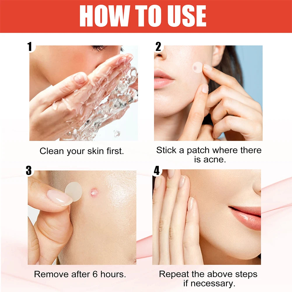 Hydrocolloid Acne Pimple Patches – Invisible Spot Care Set