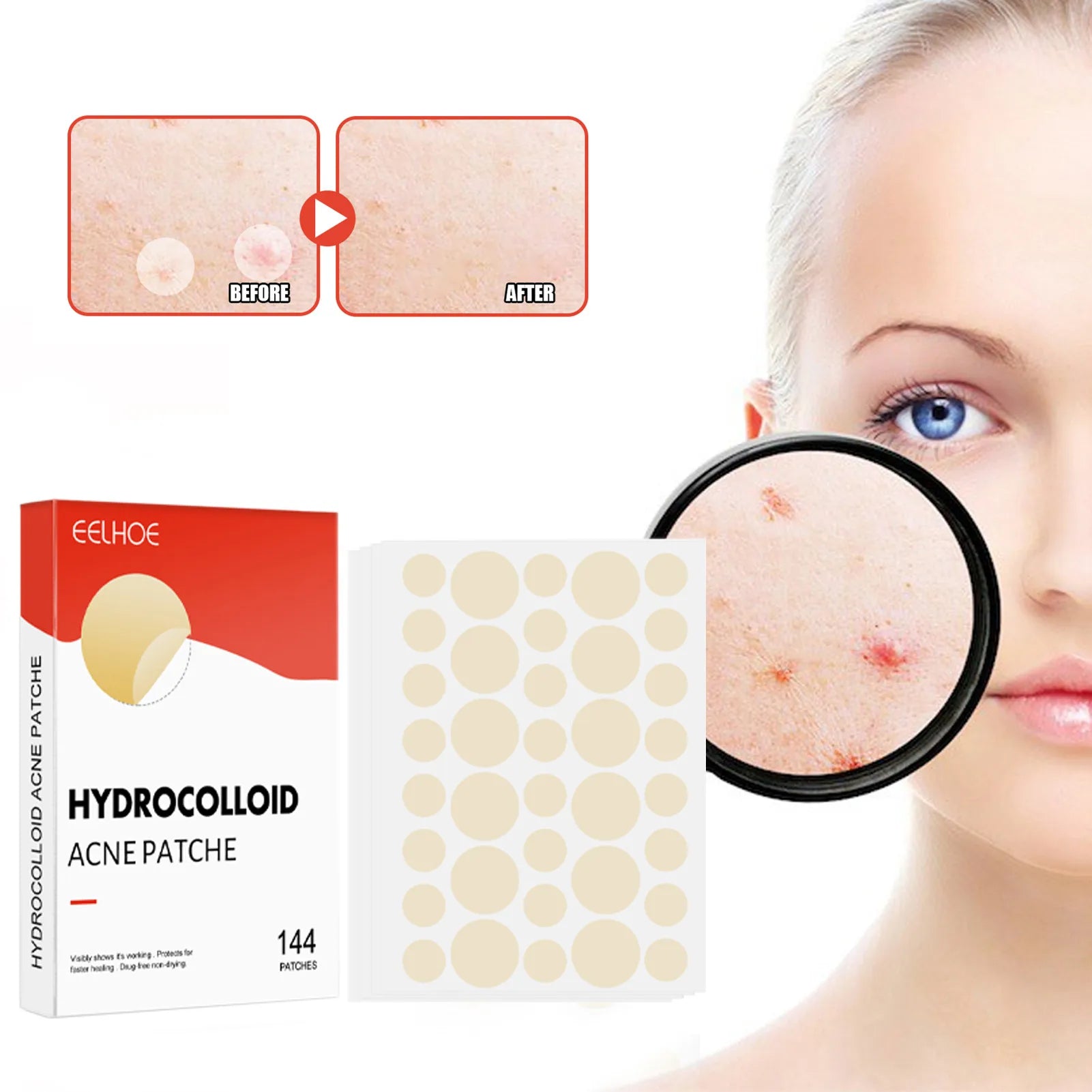 Hydrocolloid Acne Pimple Patches – Invisible Spot Care Set