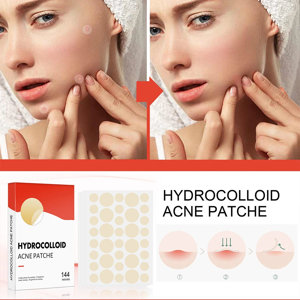 Hydrocolloid Acne Pimple Patches – Invisible Spot Care Set